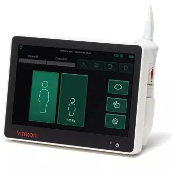 Bladder scanner / Scanner vésical portable eVue VitaScan