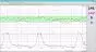 Logiciel PC MFM-CNS Lite pour cardiotocographe Edan F3