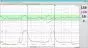 Logiciel PC MFM-CNS Lite pour cardiotocographe Edan F3