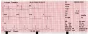 Electrocardiographe ECG Vétérinaire Edan VE300 (3 pistes)